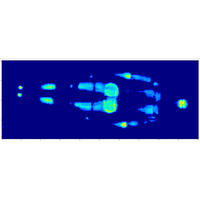Bellecour literie Privilège - Illustration de la pression totale