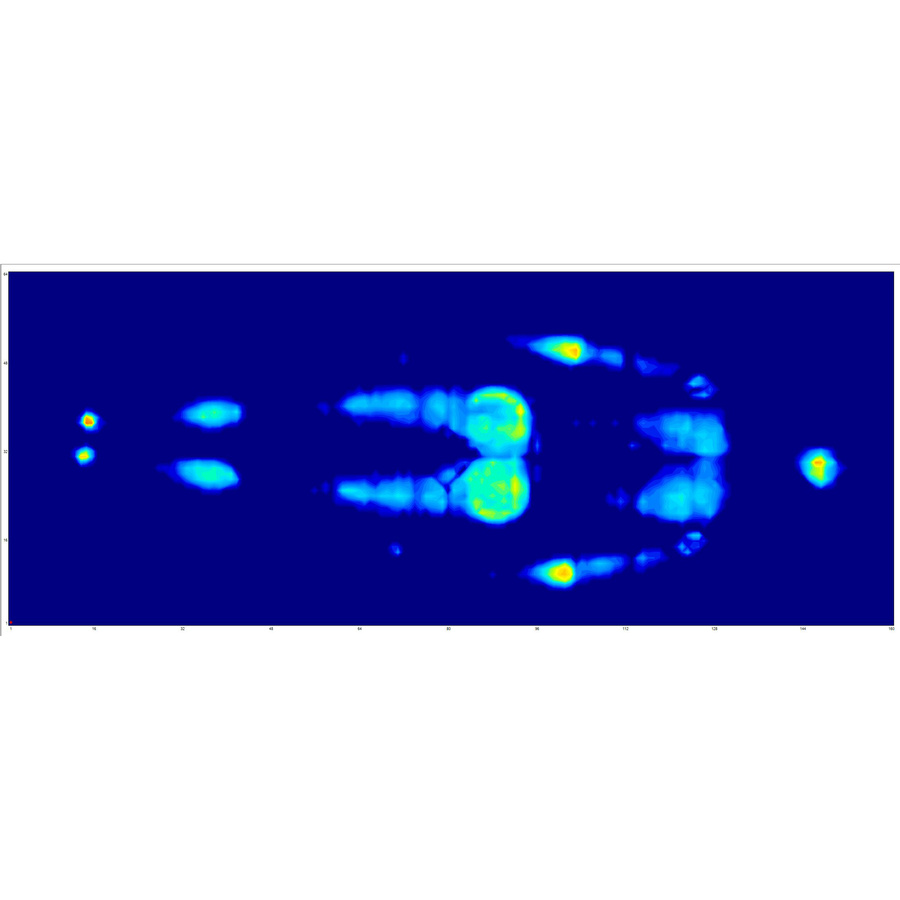 Dreaméa (But) Séquoia - Illustration de la pression totale