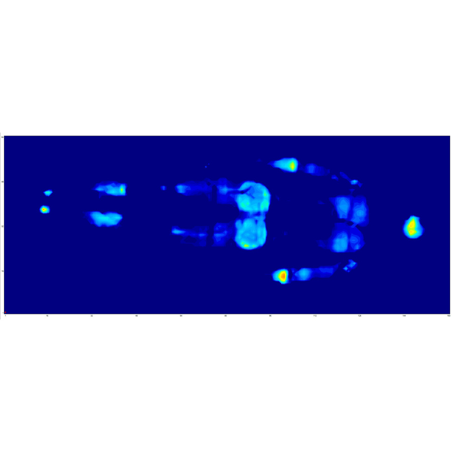 Epeda Muse 3 - Illustration de la pression totale