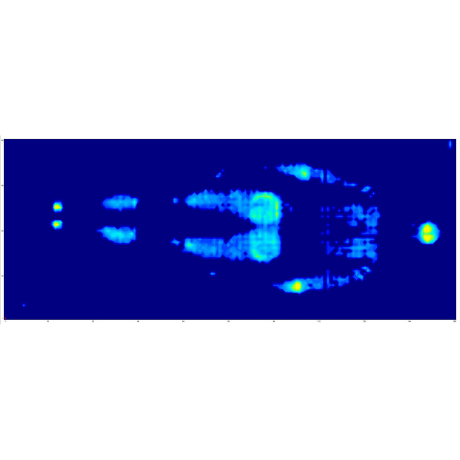 No Stress Privilège - Illustration de la pression totale